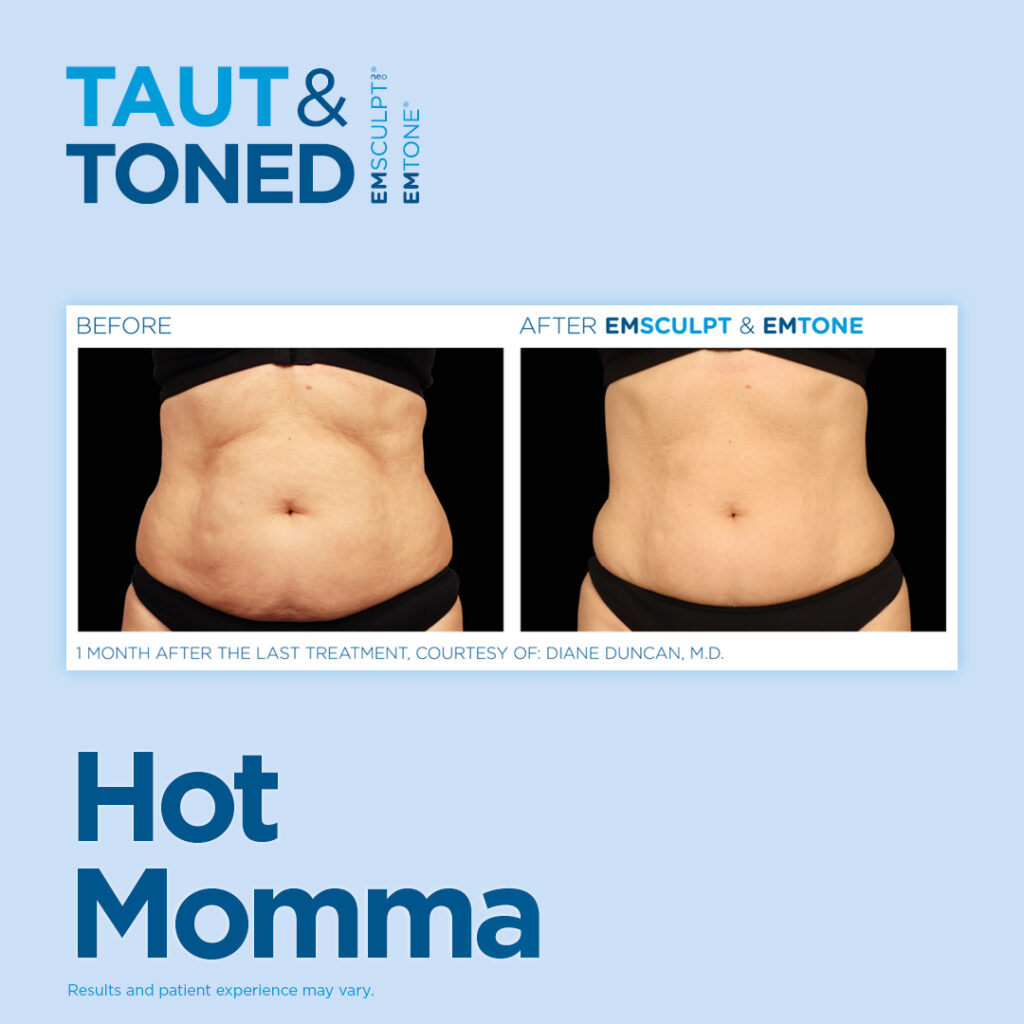 Body Sculpting in Scottsdale