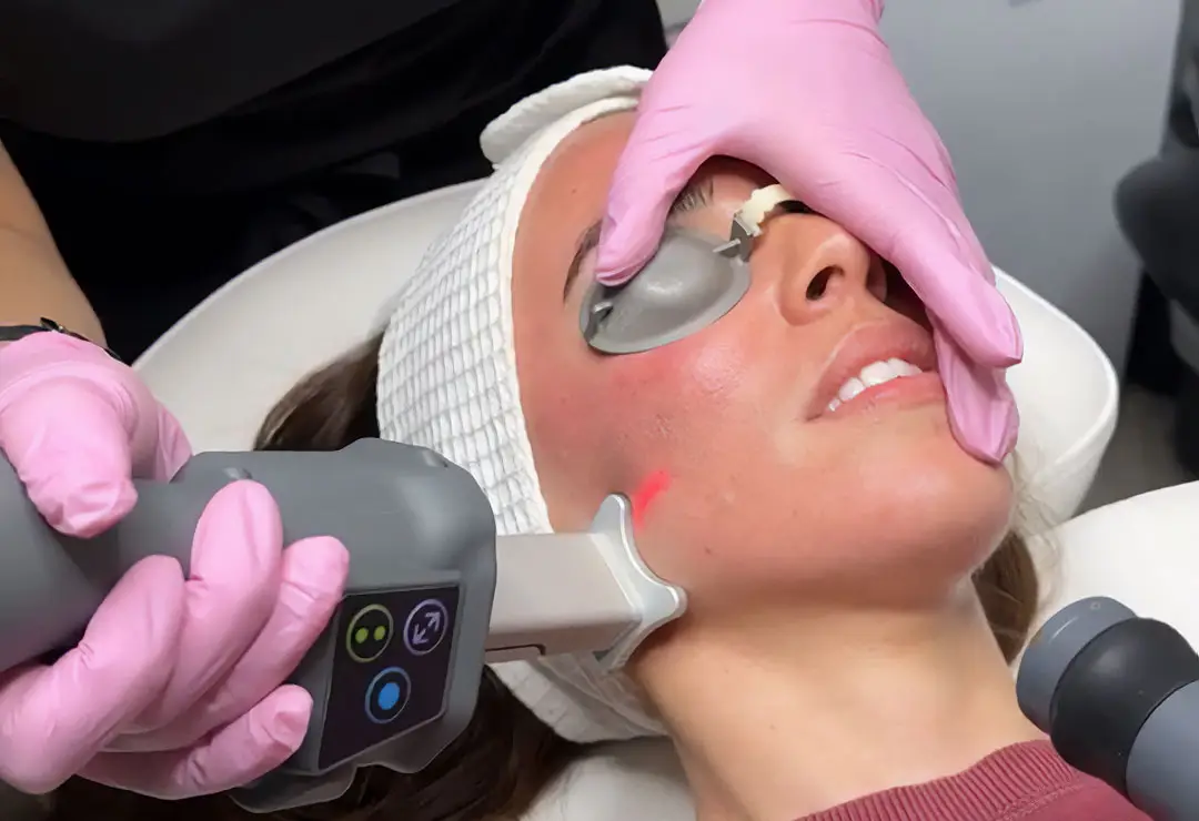 Skin Tightening Vs Resurfacing