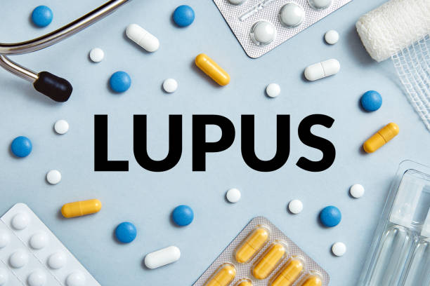 LIVING WITH LUPUS