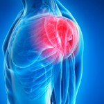 Shoulder Pain