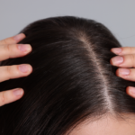 Woman with healthy hair illustrating the connection between nitric oxide, scalp circulation, and hair wellness
