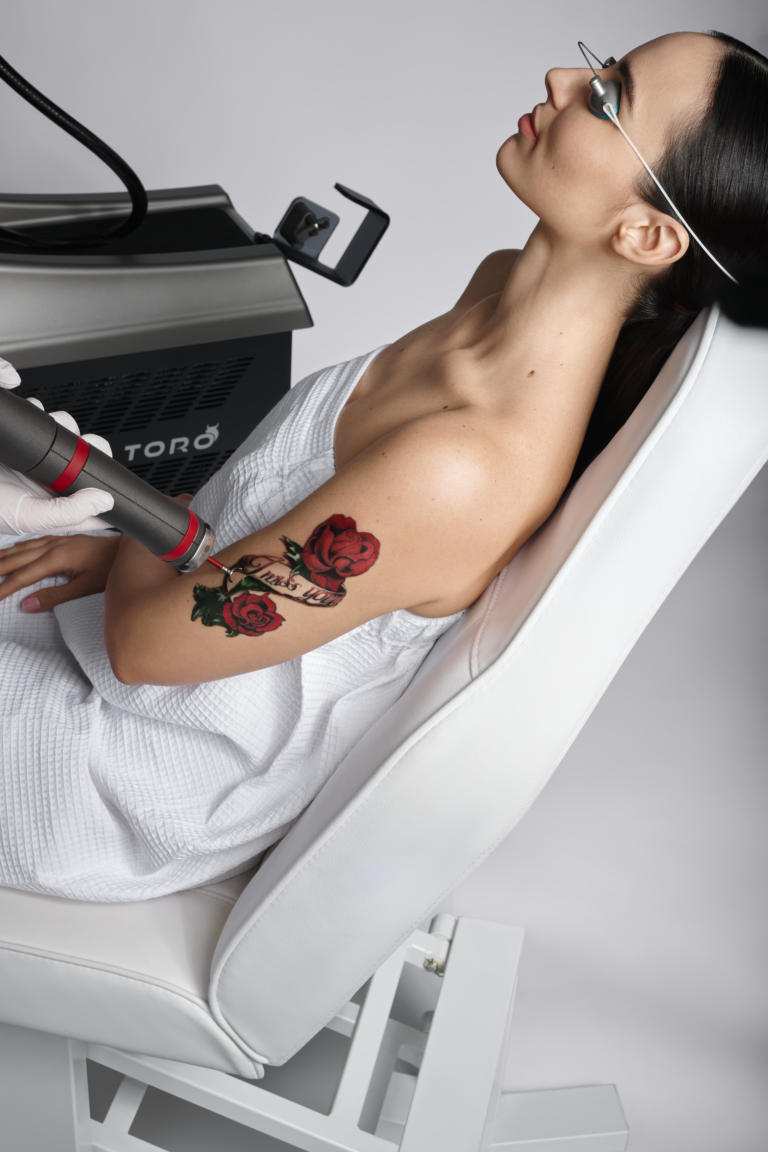 Woman with a floral back tattoo receiving a Toro laser treatment for tattoo removal at The Peak Wellness Spa in Scottsdale, AZ.